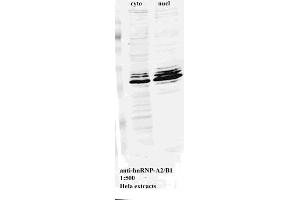 Western blot for Anti-hnRNP-A2/B1 on HeLa cell extract (HNRNPA2B1 antibody)
