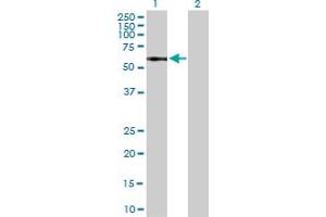Western Blot analysis of IL13RA1 expression in transfected 293T cell line by IL13RA1 MaxPab polyclonal antibody. (IL13 Receptor alpha 1 antibody  (AA 1-427))
