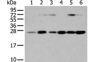 Western Blot analysis of Human placenta tissue and hela cell, hepg2 cell and Human fetal liver tissue, A549 cell and Human normal kidney tissue using SNAP23 Polyclonal Antibody at dilution of 1:400 (SNAP23 antibody)