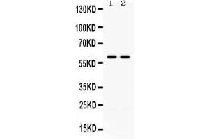 Western blot analysis of CCT3 using anti- CCT3 antibody . (CCT3 antibody  (C-Term))
