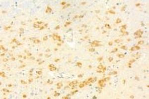Immunohistochemistry analysis of paraffin-embedded mouse brain using,KPNB1 (ABIN7074398) at dilution of 1: 1000 (KPNB1 antibody)