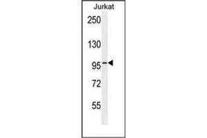 Western blot analysis of RBL2 / p130 Antibody (N-term) in Jurkat cell line lysates (35ug/lane).