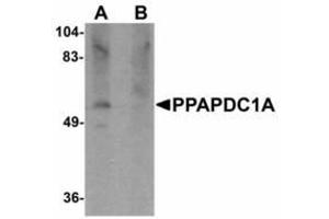 Image no. 1 for anti-Phosphatidic Acid Phosphatase Type 2 Domain Containing 1A (PPAPDC1A) (C-Term) antibody (ABIN478207) (PPAPDC1A antibody  (C-Term))