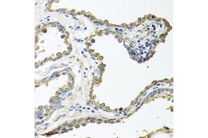 Immunohistochemistry of paraffin-embedded human prostate using COLEC11 antibody at dilution of 1:100 (40x lens). (COLEC11 antibody)