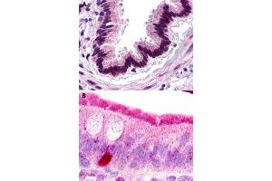 Immunohistochemical staining of formalin-fixed paraffin-embedded human lung, respiratory epithelium (A) and human small intestine (B) with C3AR1 polyclonal antibody . (C3AR1 antibody  (Extracellular Domain))
