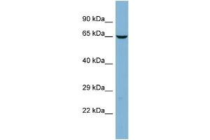 Host:  Rabbit  Target Name:  TMCC2  Sample Type:  PANC1 Whole cell lysates  Antibody Dilution:  1. (TMCC2 antibody  (Middle Region))