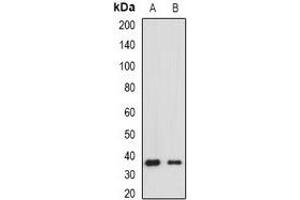 Western blot analysis of HLA-DRA expression in Raji (A), Jurkat (B) whole cell lysates. (HLA-DRA antibody)