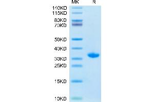 SARS-CoV-2 3CLpro (S144A) on Tris-Bis PAGE under reduced condition. (SARS-Coronavirus Nonstructural Protein 8 (SARS-CoV NSP8) (S144A) Protein)