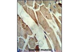 Formalin-fixed and paraffin-embedded human skeletal muscle reacted with the primary antibody, which was peroxidase-conjugated to the secondary antibody, followed by AEC staining. (CKM antibody  (C-Term))