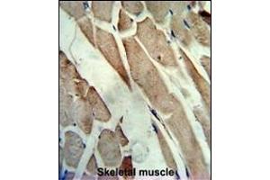 Formalin-fixed and paraffin-embedded human skeletal muscle reacted with the primary antibody, which was peroxidase-conjugated to the secondary antibody, followed by AEC staining. (CKM antibody  (C-Term))