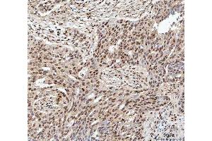 IHC analysis of SDE2 using anti-SDE2 antibody (ABIN7599603). (C1orf55 antibody  (AA 10-447))
