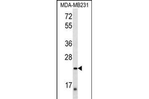PEX11A Antibody (Center) (ABIN657084 and ABIN2837890) western blot analysis in MDA-M cell line lysates (35 μg/lane). (PEX11A antibody  (AA 137-165))