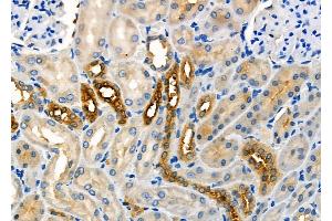 ABIN6259232 and ABIN6275659 at 1/100 staining Rat kidney tissue by IHC-P. (USP45 antibody  (Internal Region))