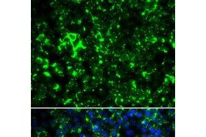 KCNA2 antibody