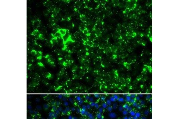 KCNA2 antibody