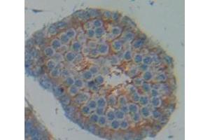 Figure. (N-Cadherin antibody  (AA 144-273))