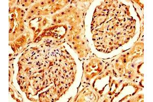 IHC image of ABIN7143857 diluted at 1:200 and staining in paraffin-embedded human kidney tissue performed on a Leica BondTM system. (CRYAB antibody  (AA 1-175))