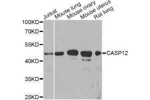 Western blot analysis of extracts of various cell lines, using CASP12 Antibody. (Caspase 12 antibody)