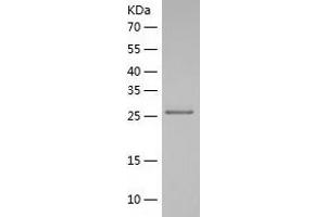 Western Blotting (WB) image for Polyglutamine Binding Protein 1 (PQBP1) (AA 1-265) protein (His tag) (ABIN7284549) (PQBP1 Protein (AA 1-265) (His tag))