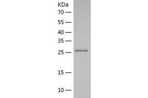 PQBP1 Protein (AA 1-265) (His tag)