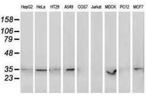 Image no. 2 for anti-Retinol Dehydrogenase 14 (All-Trans/9-Cis/11-Cis) (RDH14) antibody (ABIN1500657) (RDH14 antibody)