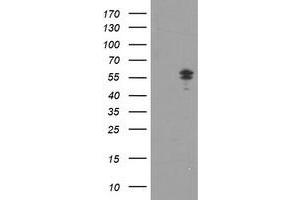 HEK293T cells were transfected with the pCMV6-ENTRY control (Left lane) or pCMV6-ENTRY NONO (Right lane) cDNA for 48 hrs and lysed. (NONO antibody  (AA 184-385))