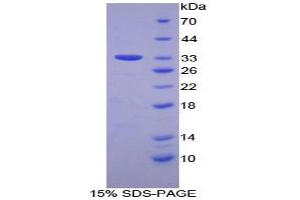 SDS-PAGE analysis of Human FOS Like Antigen 1 Protein. (FOSL1 Protein)