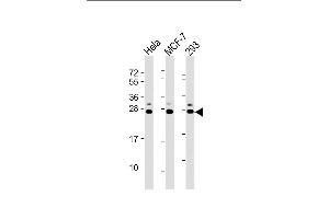All lanes : Anti-KDELR1 Antibody (C-term) at 1:2000 dilution Lane 1: Hela whole cell lysate Lane 2: MCF-7 whole cell lysate Lane 3: 293 whole cell lysate Lysates/proteins at 20 μg per lane.