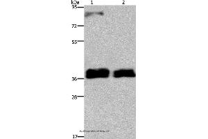 Western blot analysis of 231 and A172 cell, using FETUB Polyclonal Antibody at dilution of 1:700 (FETUB antibody)