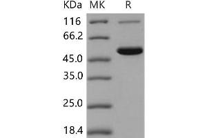Western Blotting (WB) image for Carboxylesterase 2 (CES2) (Active) protein (His tag) (ABIN7194592) (CES2 Protein (His tag))
