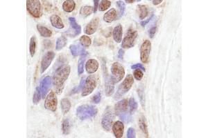 Immunohistochemistry (IHC) image for anti-CoaA (AA 150-200) antibody (ABIN7448480) (CoaA (AA 150-200) antibody)