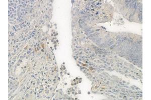 anti-Zinc Finger Protein 592 (ZNF592) (Internal Region) antibody