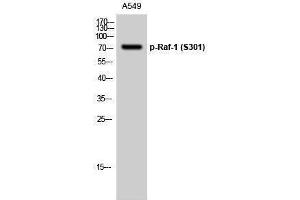 Western Blotting (WB) image for anti-V-Raf-1 Murine Leukemia Viral Oncogene Homolog 1 (RAF1) (pSer301) antibody (ABIN3173093) (RAF1 antibody  (pSer301))