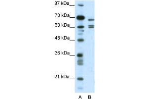 WB Suggested Anti-KCNK5 Antibody Titration:  0. (KCNK5 antibody  (C-Term))