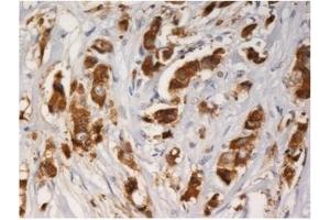 Immunohistochemistry (IHC) image for anti-Anterior Gradient 3 (AGR3) antibody (ABIN614768) (AGR3 antibody)