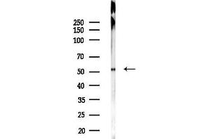 anti-Coagulation Factor VII (F7) antibody