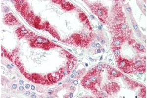 Human Kidney: Formalin-Fixed, Paraffin-Embedded (FFPE) (CLPB antibody  (AA 575-624))