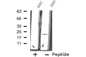 RPL11 antibody  (C-Term)