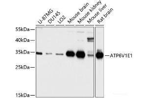 Western blot analysis of extracts of various cell lines using ATP6V1E1 Polyclonal Antibody at dilution of 1:1000. (ATP6V1E1 antibody)