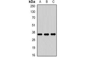 Western blot analysis of RASSF1 expression in Hela (A), HepG2 (B), SW480 (C) whole cell lysates.