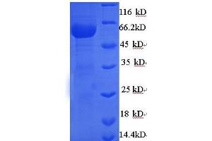 SDS-PAGE (SDS) image for NCAP (AA 1-450), (full length) protein (His tag) (ABIN5714044) (NCAP (AA 1-450), (full length) protein (His tag))
