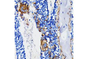 Immunohistochemistry (IHC) image for anti-Integrin beta 3 (ITGB3) antibody (ABIN7267928)