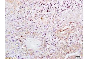 Formalin-fixed and paraffin embedded mouse lymphoma tissue labeled with Anti-Dnmt1 Polyclonal Antibody, Unconjugated  at 1:200, followed by conjugation to the secondary antibody and DAB staining (DNMT1 antibody  (AA 21-120))