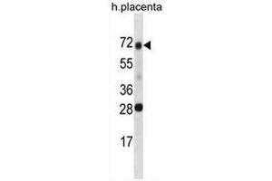 SPINT1 Antibody (Center) western blot analysis in human placenta tissue lysates (35µg/lane). (SPINT1 antibody  (Middle Region))