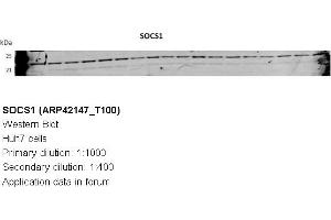 Image no. 3 for anti-Suppressor of Cytokine Signaling 1 (SOCS1) (N-Term) antibody (ABIN310288) (SOCS1 antibody  (N-Term))