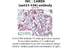 Image no. 1 for anti-Caspase Recruitment Domain Family, Member 9 (CARD9) (AA 521-536) antibody (ABIN1732641) (CARD9 antibody  (AA 521-536))