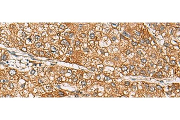 DCAF12 antibody