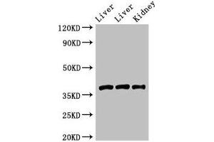 Western Blot Positive WB detected in: Rat liver tissue, Mouse liver tissue, Mouse kidney tissue All lanes: GNB4 antibody at 2 μg/mL Secondary Goat polyclonal to rabbit IgG at 1/50000 dilution Predicted band size: 38 kDa Observed band size: 38 kDa (GNB4 antibody  (AA 105-185))