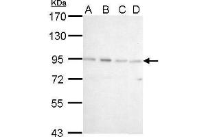 WB Image CSDE1 antibody [N2C1], Internal detects CSDE1 protein by Western blot analysis.