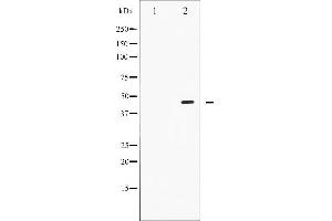 Western blot analysis of Smad2/3 phosphorylation expression in RAW264. (Smad2/3 antibody  (pThr8, Thr8))